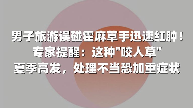 男子旅游误碰霍麻草手迅速红肿！专家提醒：这种"咬人草"夏季高发，处理不当恐加重症状